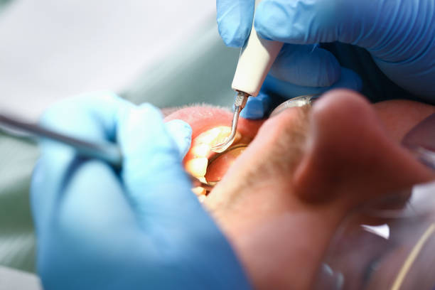 Best Broken or Cracked Tooth Emergency Dentist in Horse Pasture, VA