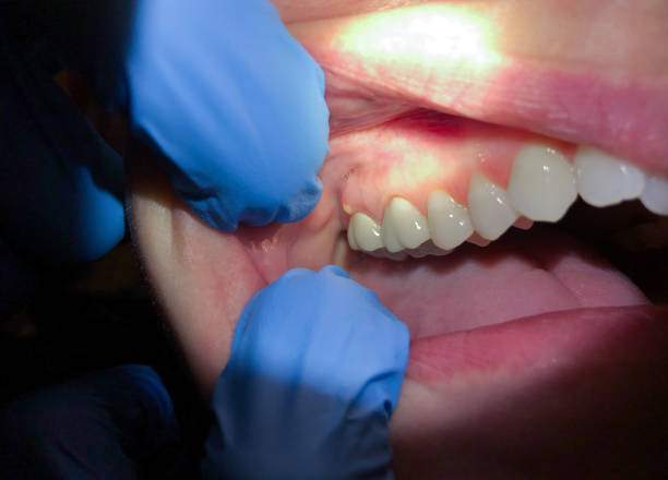 Best Emergency Dental Services for Seniors in Horse Pasture, VA