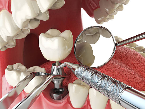 Best Broken or Cracked Tooth Emergency Dentist in Horse Pasture, VA
